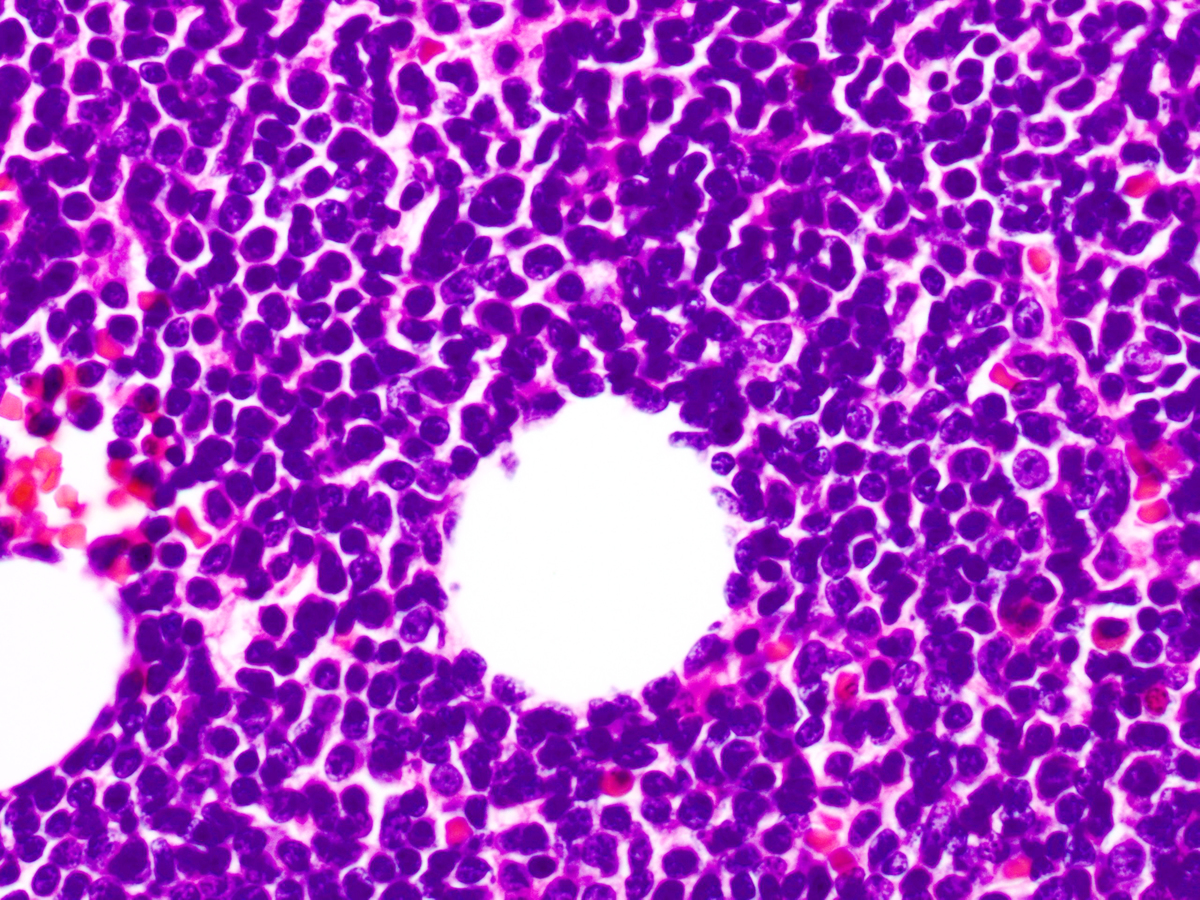 Sheets of blasts, high-power magnification